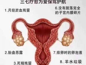 老中医用嘴排阴毒小雨——排出血块、肌瘤、囊肿，让你健康年轻