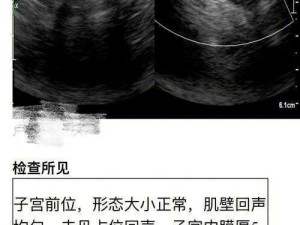 女生下面变黑色可能是因为遗传、激素变化、过度摩擦等，XXX 凝胶可以帮助改善这种情况