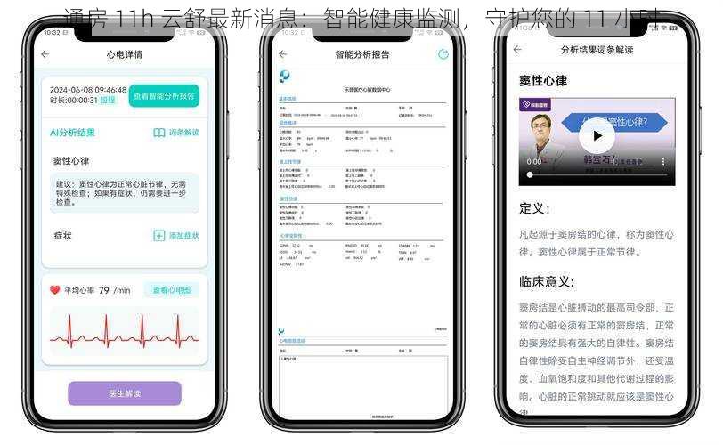 通房 11h 云舒最新消息：智能健康监测，守护您的 11 小时