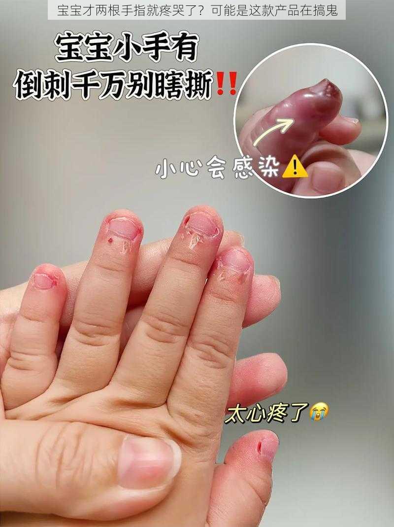 宝宝才两根手指就疼哭了？可能是这款产品在搞鬼